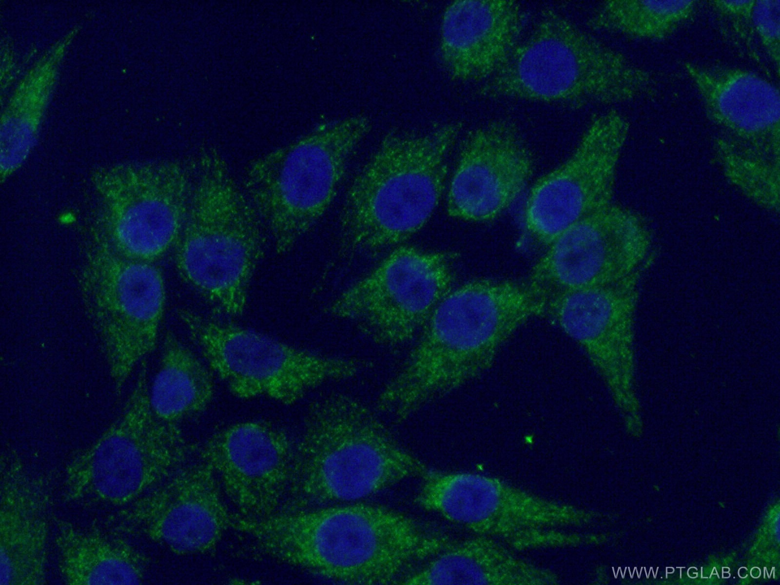 IF Staining of A375 using 12212-1-AP