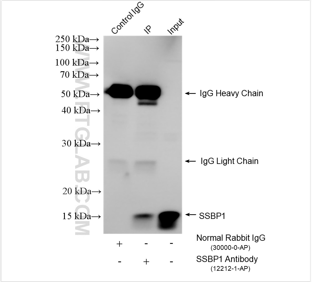 Immunoprecipitation (IP) experiment of A375 cells using SSBP1 Polyclonal antibody (12212-1-AP)