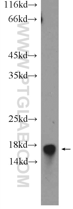 Western Blot (WB) analysis of rat pancreas tissue using SSBP1 Polyclonal antibody (12212-1-AP)