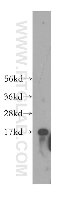 Western Blot (WB) analysis of mouse pancreas tissue using SSBP1 Polyclonal antibody (12212-1-AP)