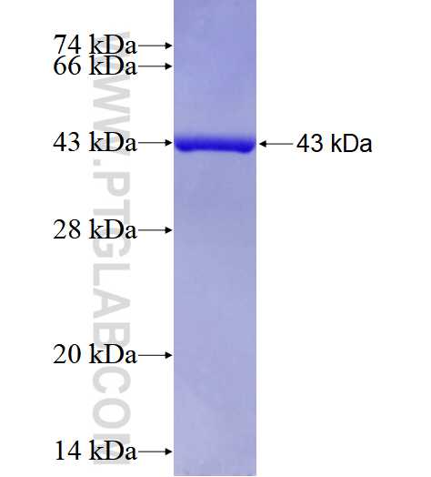 SSBP1 fusion protein Ag2860 SDS-PAGE