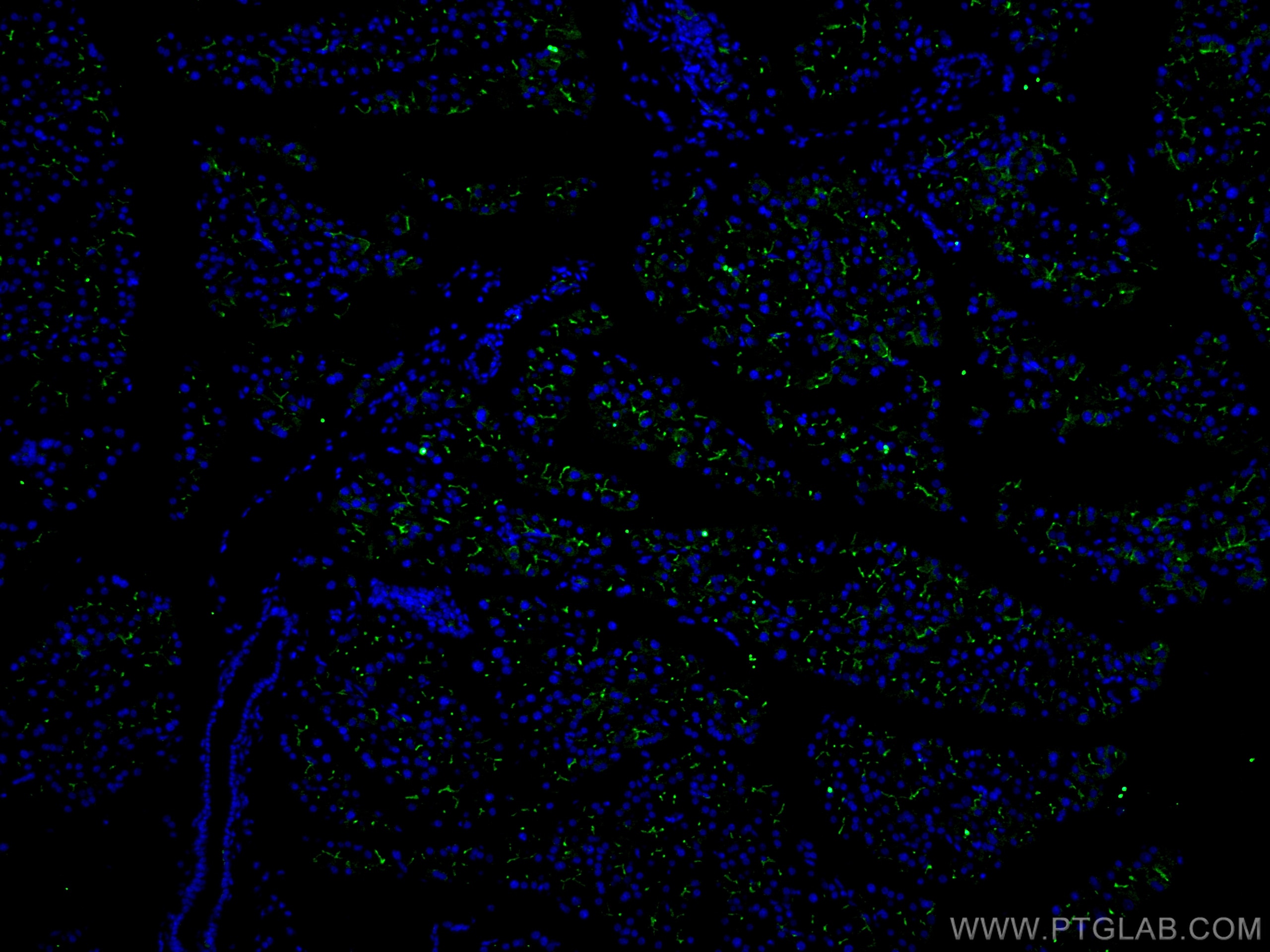 Immunofluorescence (IF) / fluorescent staining of mouse pancreas tissue using KRAP/SSFA2 Polyclonal antibody (14157-1-AP)