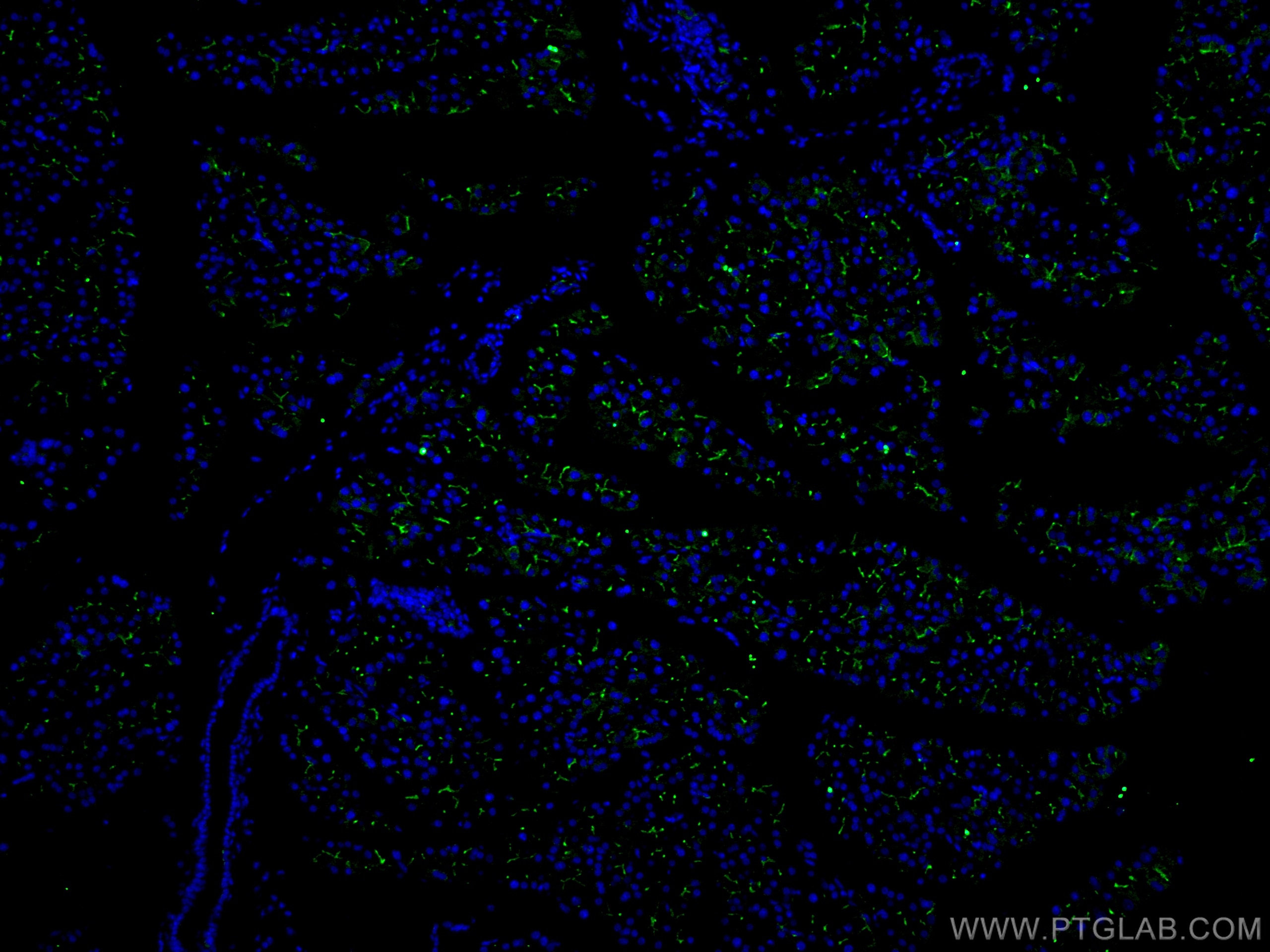 IF Staining of mouse pancreas using 14157-1-AP