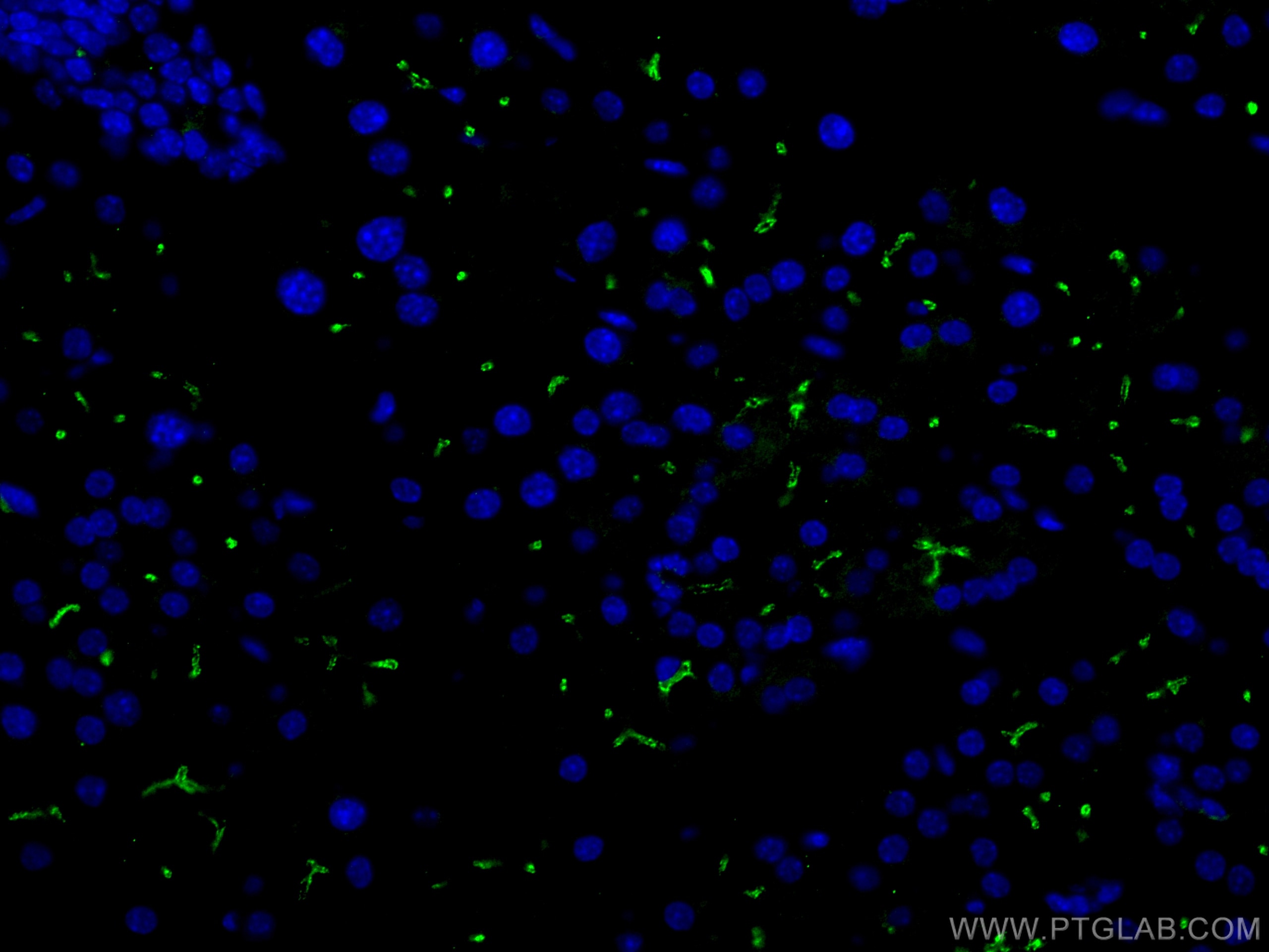 Immunofluorescence (IF) / fluorescent staining of mouse pancreas tissue using KRAP/SSFA2 Polyclonal antibody (14157-1-AP)