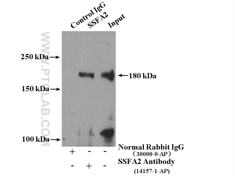 Immunoprecipitation (IP) experiment of mouse testis tissue using KRAP/SSFA2 Polyclonal antibody (14157-1-AP)