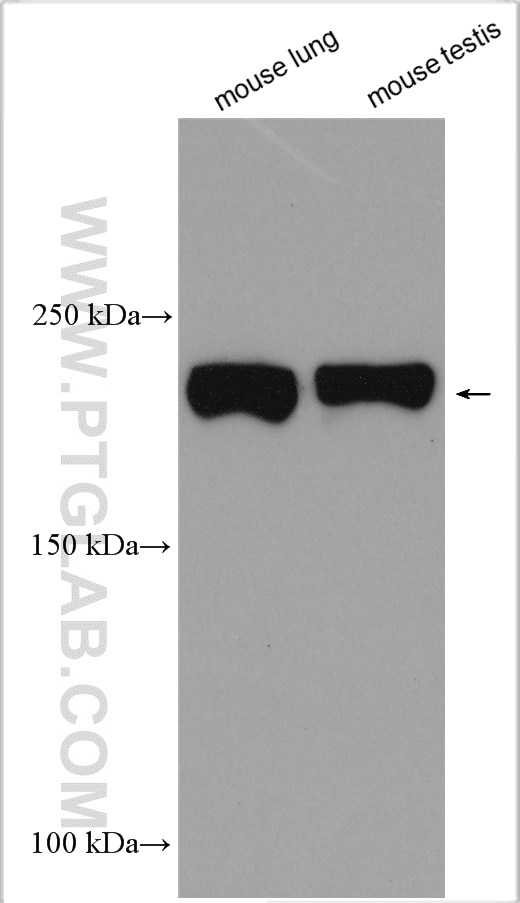 Western Blot (WB) analysis of various lysates using KRAP/SSFA2 Polyclonal antibody (14157-1-AP)