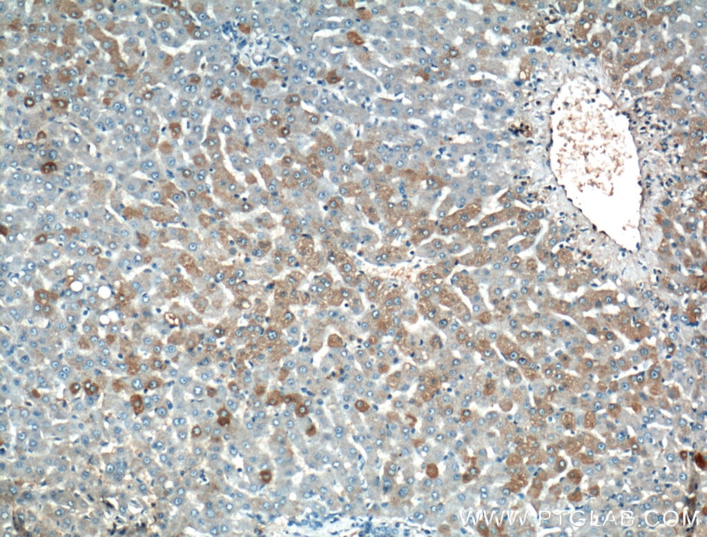 Immunohistochemistry (IHC) staining of human liver tissue using SSH2 Polyclonal antibody (20674-1-AP)