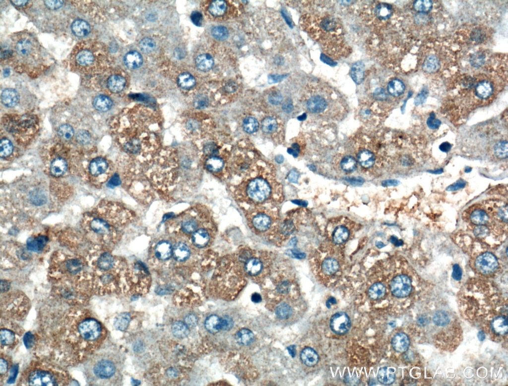 Immunohistochemistry (IHC) staining of human liver tissue using SSH2 Polyclonal antibody (20674-1-AP)