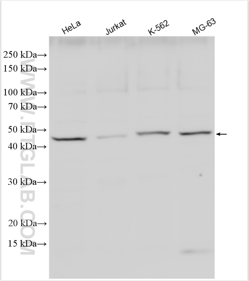 Western Blot (WB) analysis of various lysates using SSH2 Polyclonal antibody (20674-1-AP)
