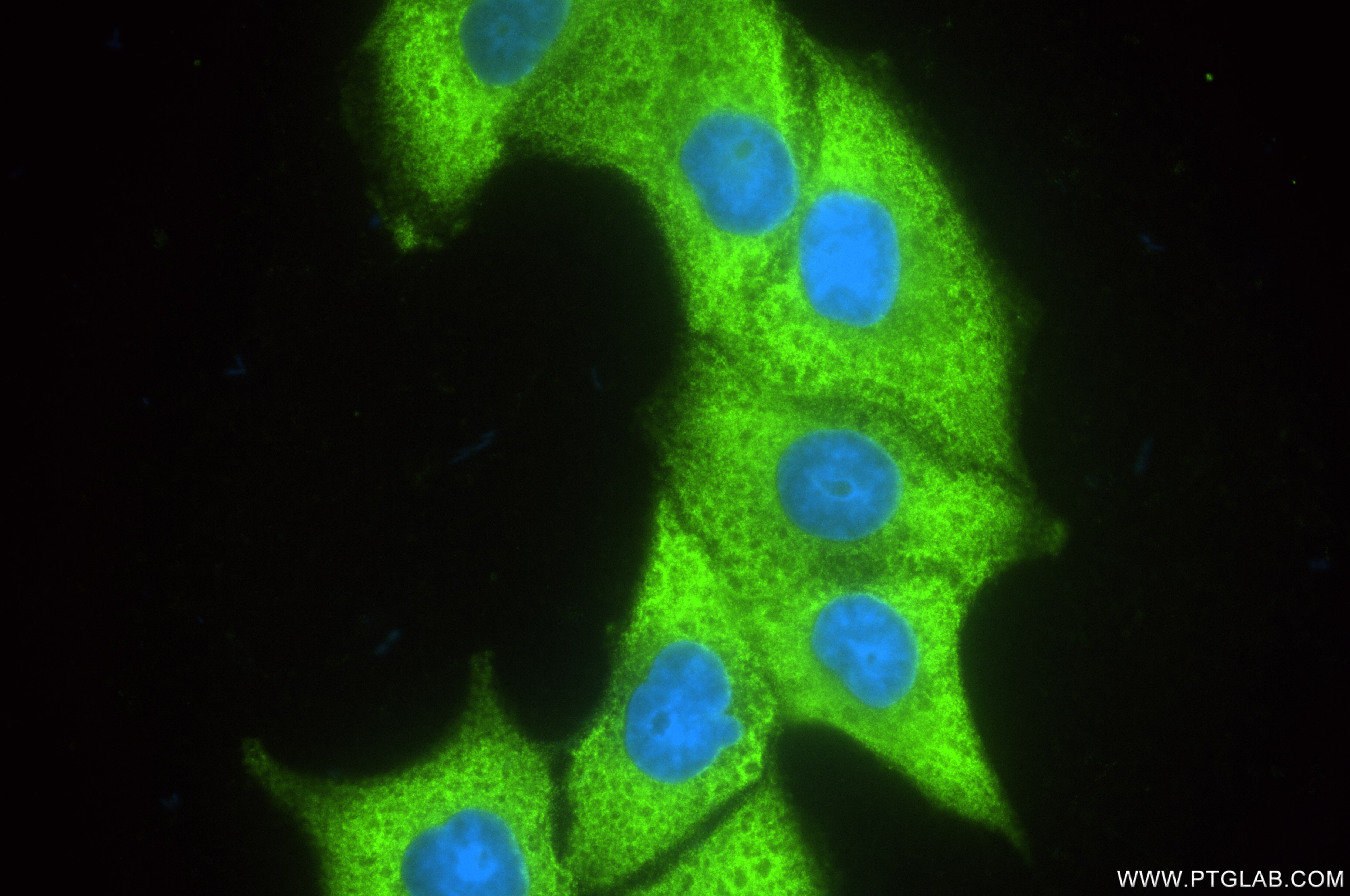 Immunofluorescence (IF) / fluorescent staining of HepG2 cells using SSH2 Recombinant antibody (85294-2-RR)