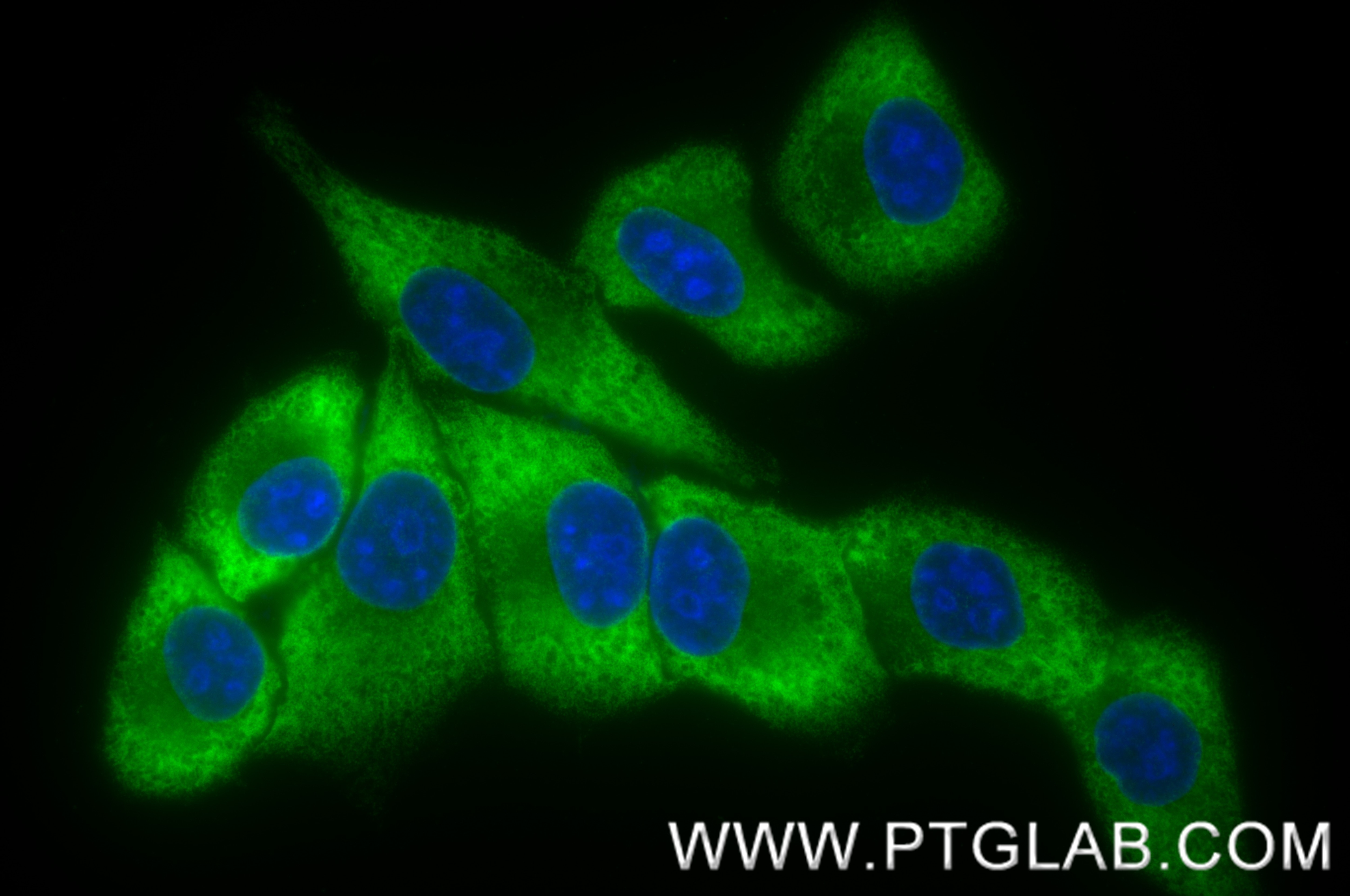 Immunofluorescence (IF) / fluorescent staining of HepG2 cells using SSH2 Recombinant monoclonal antibody (85294-2-RR)