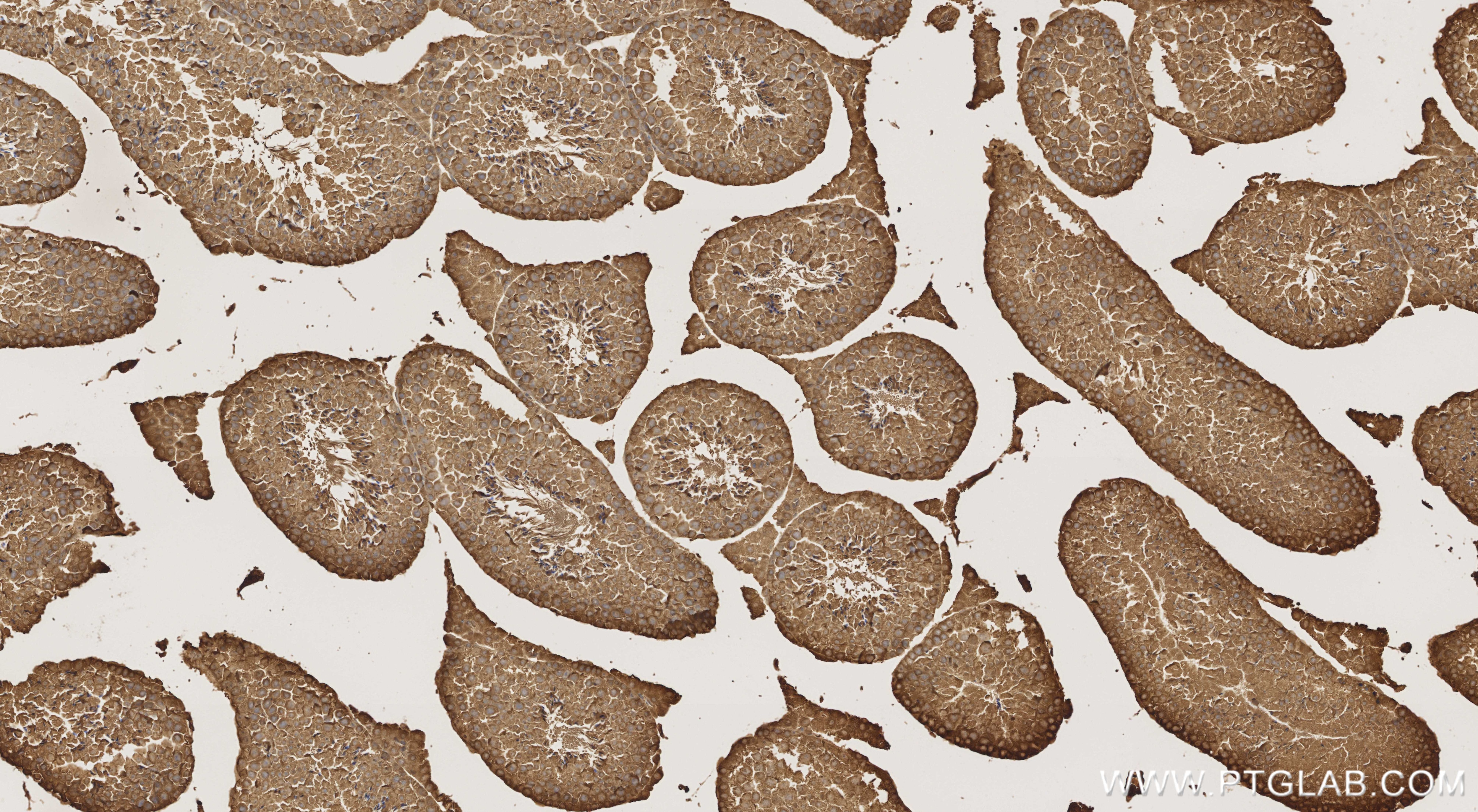 Immunohistochemistry (IHC) staining of mouse testis tissue using SSH2 Recombinant monoclonal antibody (85294-2-RR)