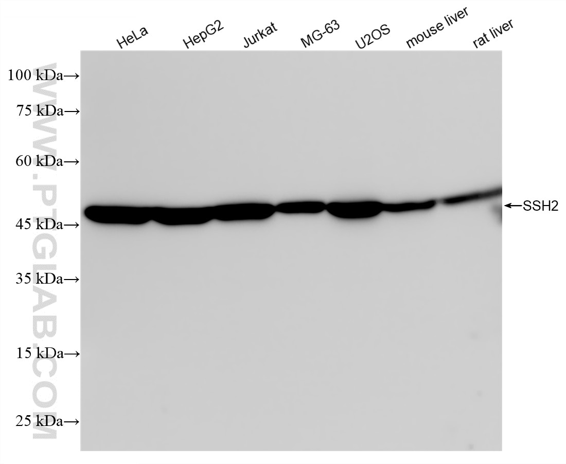 Western Blot (WB) analysis of various lysates using SSH2 Recombinant antibody (85294-2-RR)