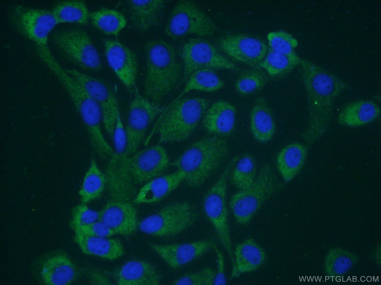 Immunofluorescence (IF) / fluorescent staining of A431 cells using SSH3 Polyclonal antibody (18324-1-AP)
