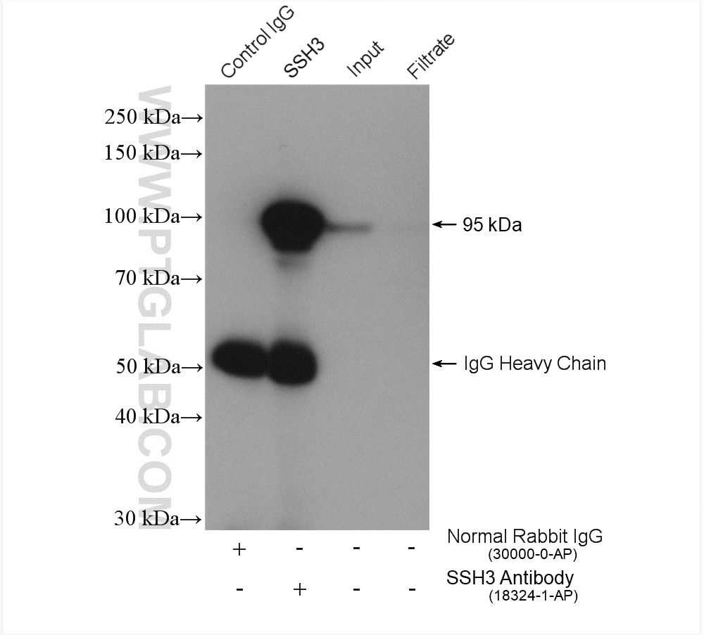 Immunoprecipitation (IP) experiment of HeLa cells using SSH3 Polyclonal antibody (18324-1-AP)