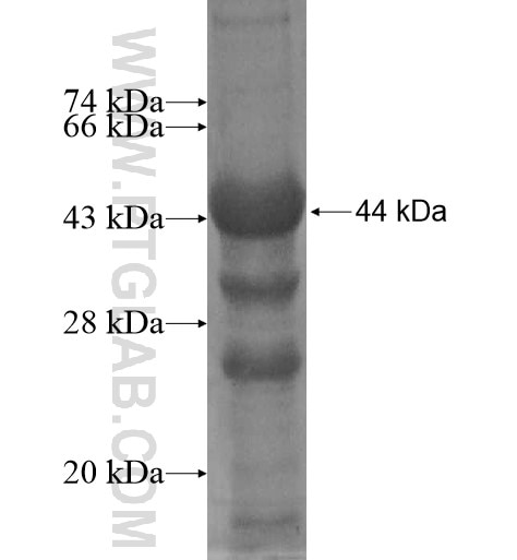 SSH3 fusion protein Ag13139 SDS-PAGE