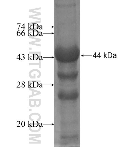 SSH3 fusion protein Ag13139 SDS-PAGE