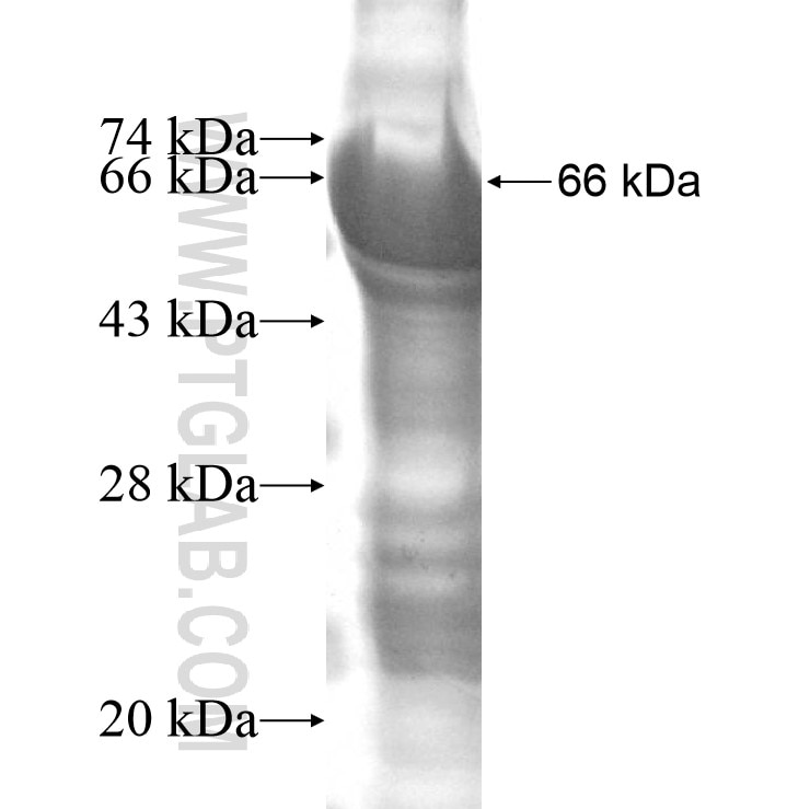 SSH3 fusion protein Ag13174 SDS-PAGE