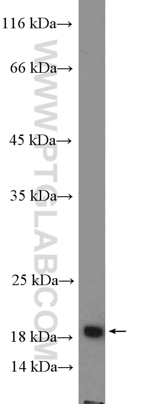 WB analysis of mouse liver using 26685-1-AP