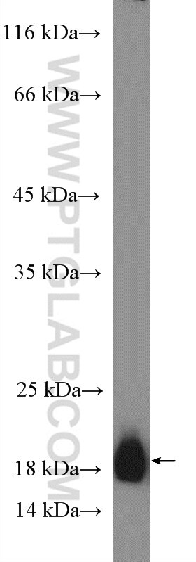 Western Blot (WB) analysis of rat liver tissue using SSPN Polyclonal antibody (26685-1-AP)