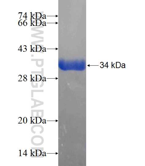 SSPN fusion protein Ag24511 SDS-PAGE