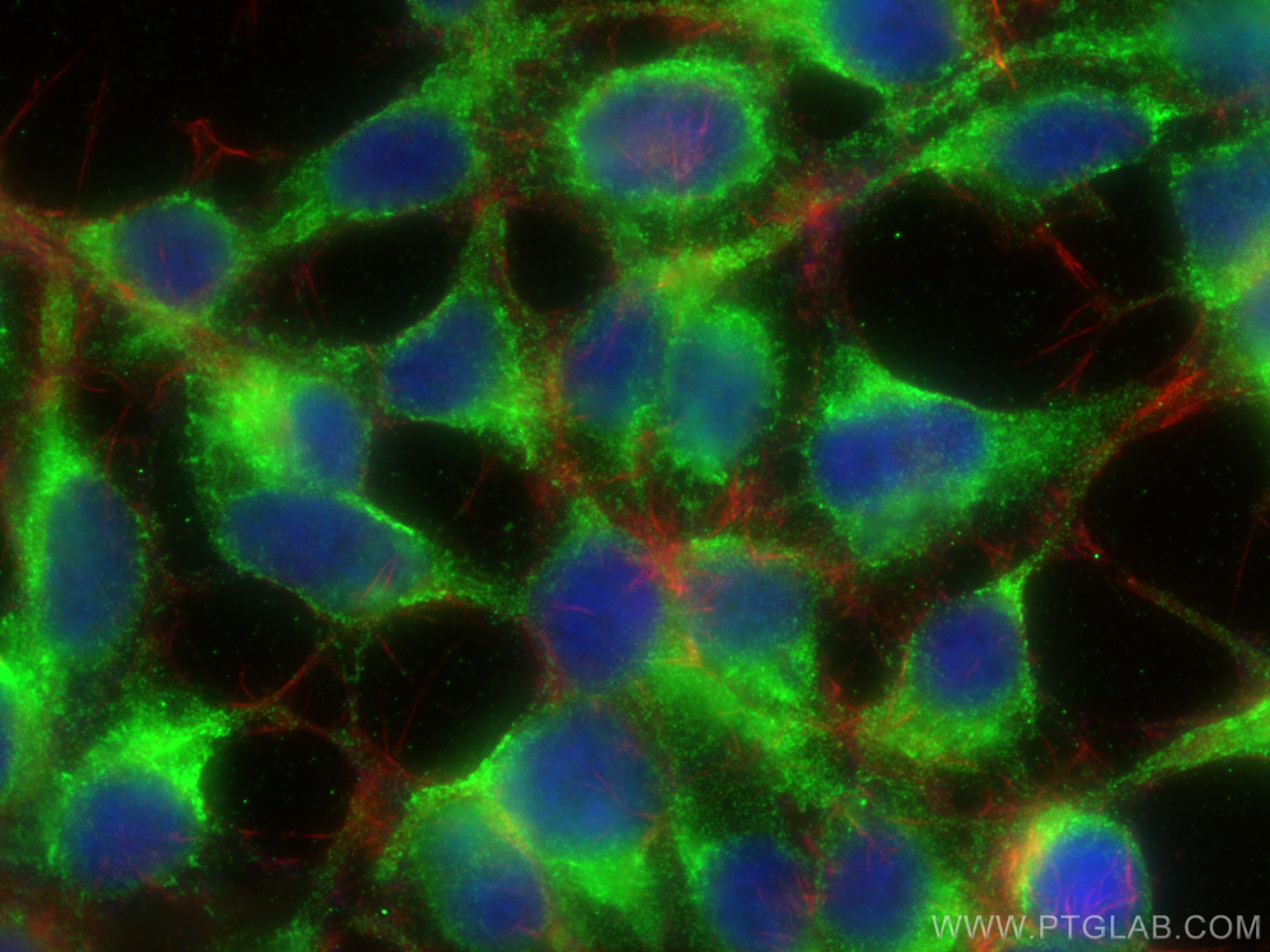 Immunofluorescence (IF) / fluorescent staining of HEK-293 cells using TRAPA/SSR1 Polyclonal antibody (10583-1-AP)
