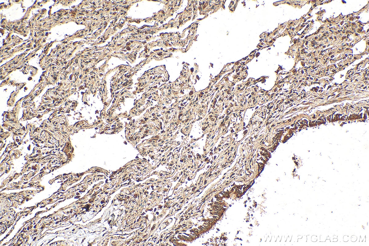 Immunohistochemistry (IHC) staining of human lung tissue using TRAPA/SSR1 Polyclonal antibody (10583-1-AP)