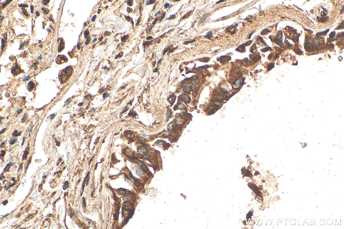 IHC staining of human lung using 10583-1-AP