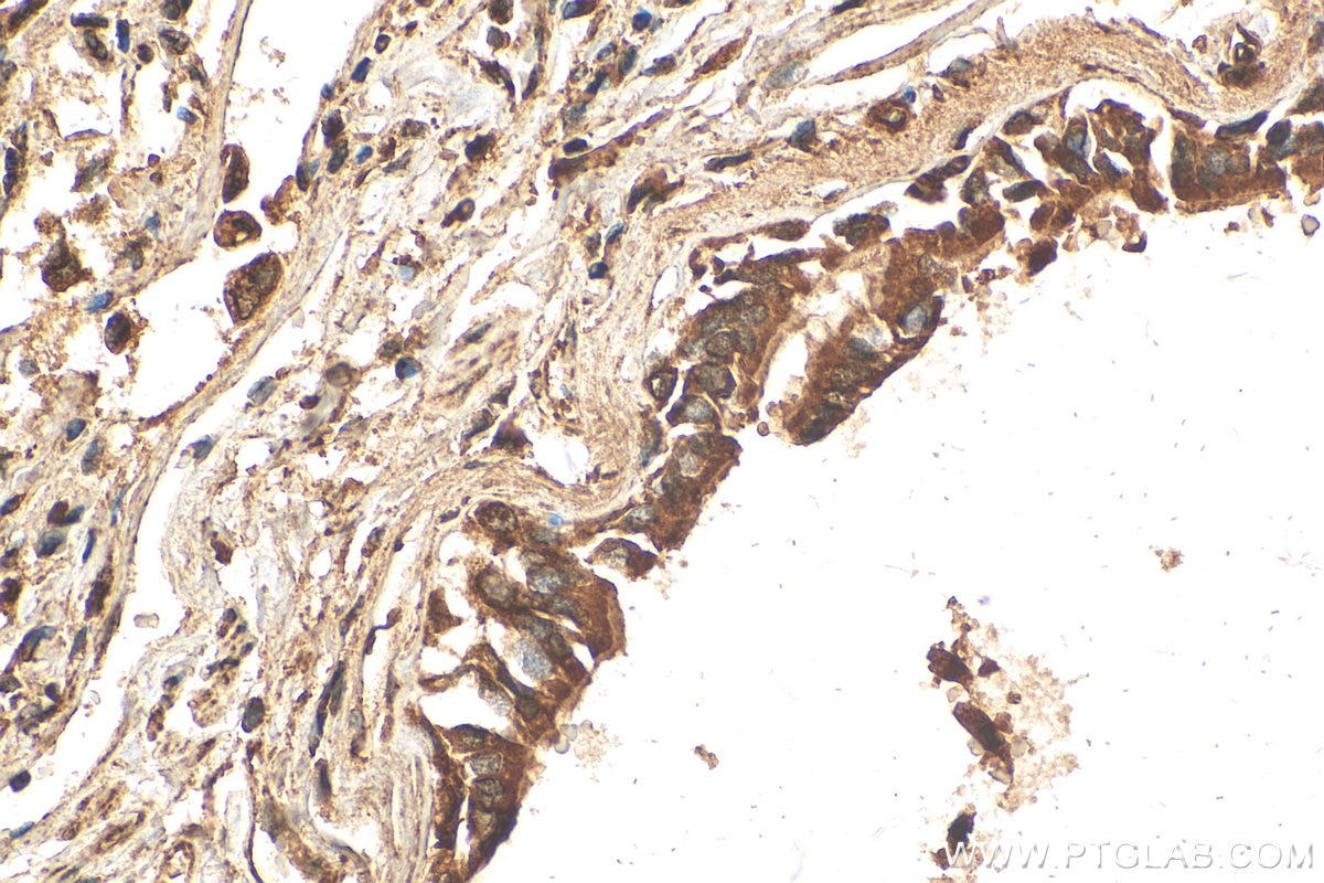 Immunohistochemistry (IHC) staining of human lung tissue using TRAPA/SSR1 Polyclonal antibody (10583-1-AP)