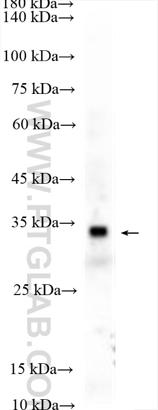Western Blot (WB) analysis of mouse liver tissue using TRAPA/SSR1 Polyclonal antibody (10583-1-AP)