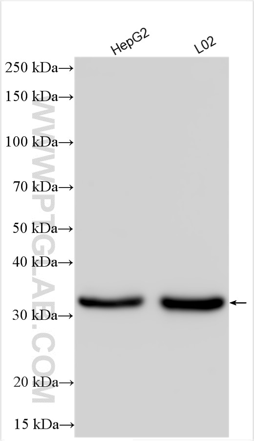 Western Blot (WB) analysis of various lysates using TRAPA/SSR1 Polyclonal antibody (10583-1-AP)