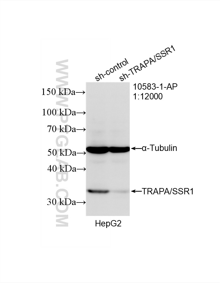 Western Blot (WB) analysis of HepG2 cells using TRAPA/SSR1 Polyclonal antibody (10583-1-AP)