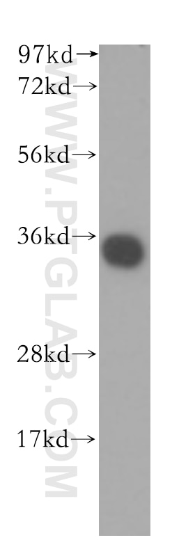 Western Blot (WB) analysis of human liver tissue using TRAPA/SSR1 Polyclonal antibody (10583-1-AP)
