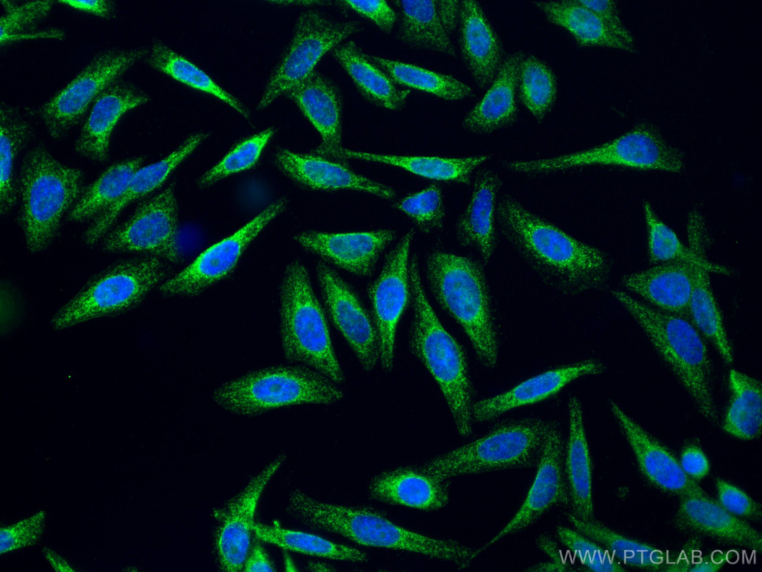 Immunofluorescence (IF) / fluorescent staining of HepG2 cells using TRAPB/SSR2 Polyclonal antibody (10278-1-AP)