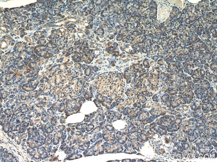 Immunohistochemistry (IHC) staining of human pancreas tissue using TRAPB/SSR2 Polyclonal antibody (10278-1-AP)