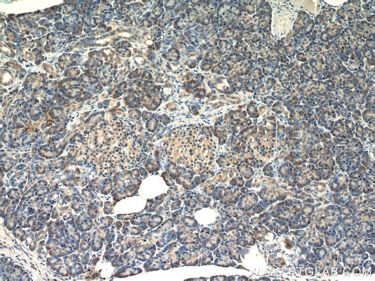 IHC staining of human pancreas using 10278-1-AP