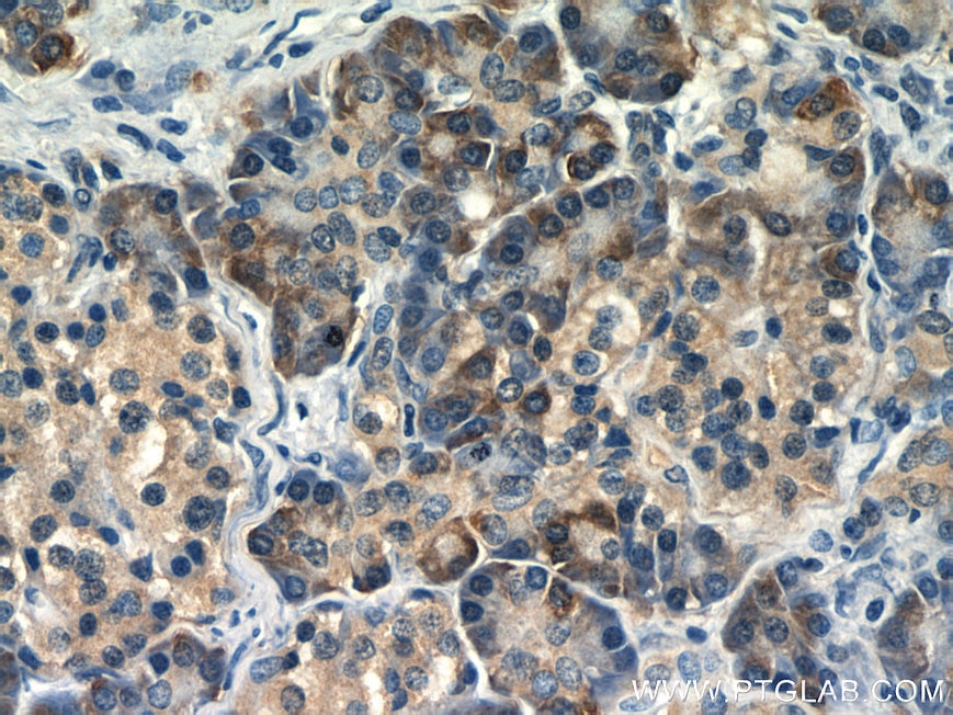 Immunohistochemistry (IHC) staining of human pancreas tissue using TRAPB/SSR2 Polyclonal antibody (10278-1-AP)