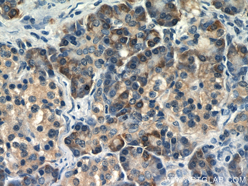 IHC staining of human pancreas using 10278-1-AP