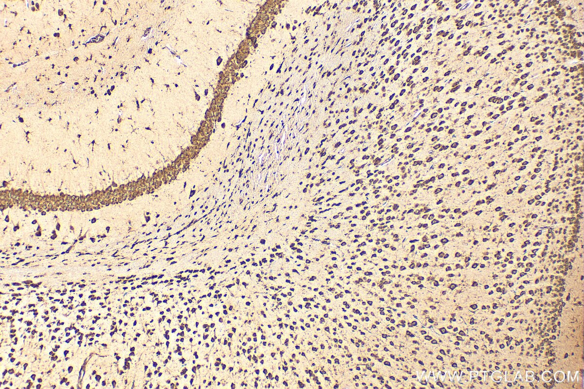 Immunohistochemistry (IHC) staining of mouse brain tissue using SSR3 Polyclonal antibody (30851-1-AP)