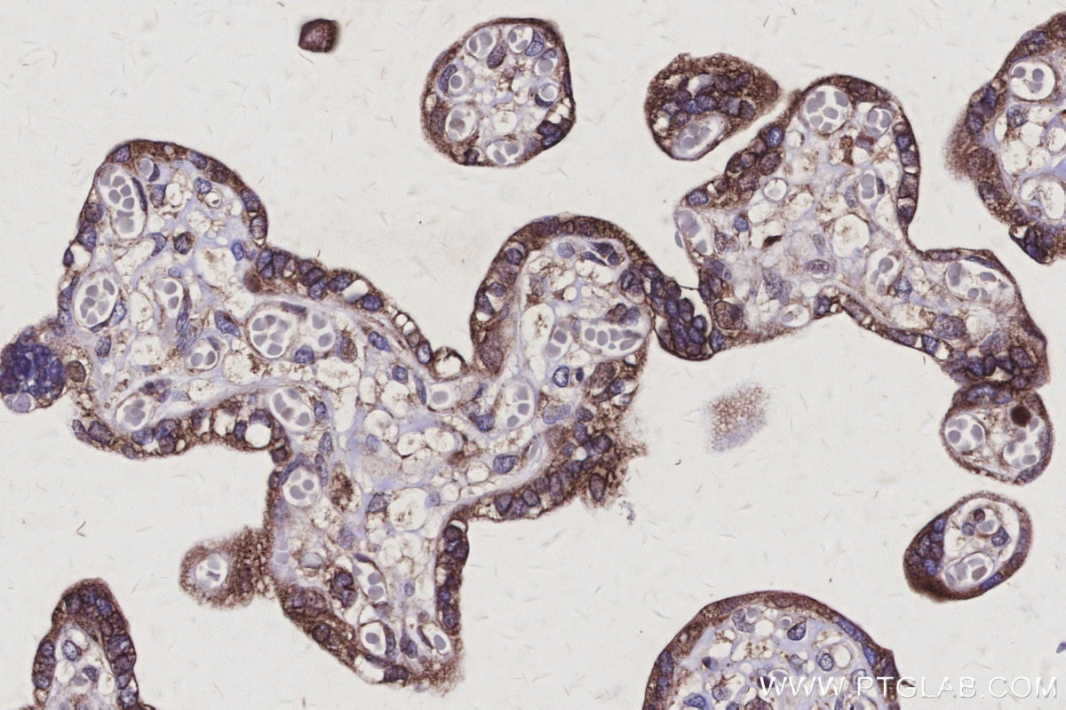IHC staining of human placenta using 30851-1-AP Immunohistochemistry (IHC) staining of human placenta tissue using SSR3 Polyclonal antibody (30851-1-AP)