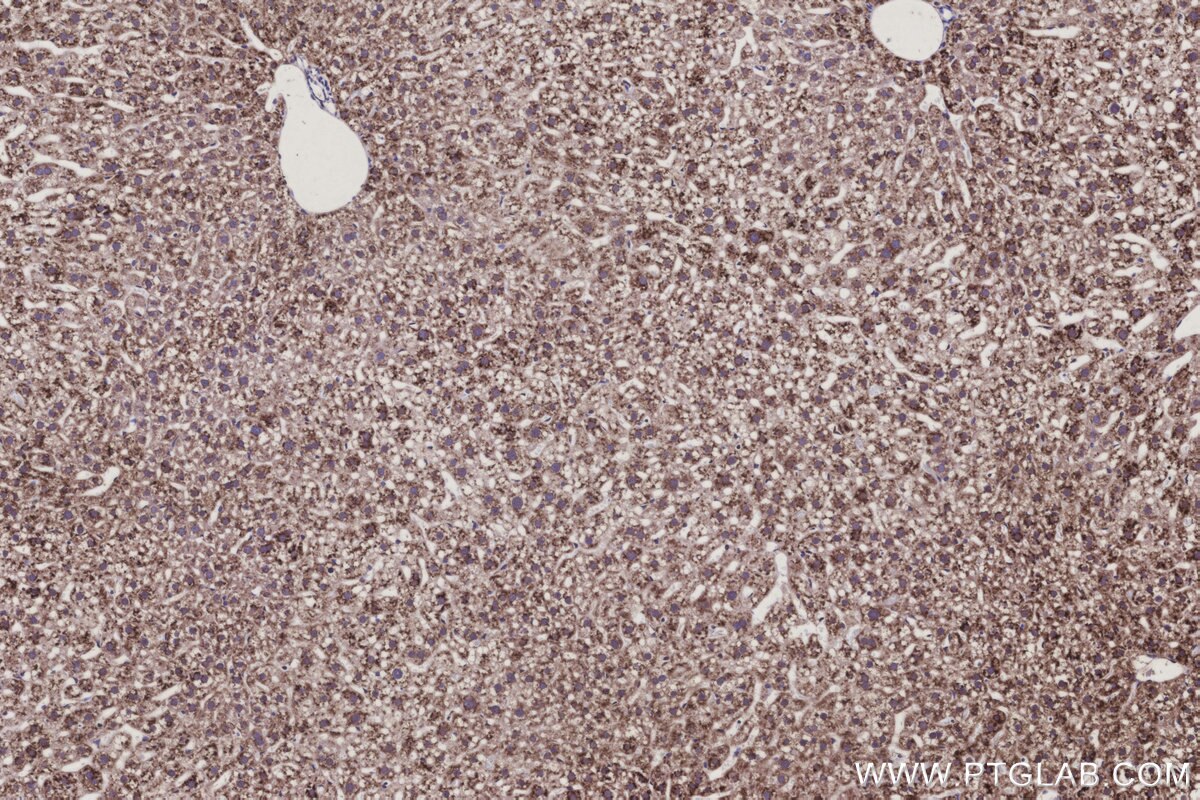 IHC staining of mouse liver using 30851-1-AP Immunohistochemistry (IHC) staining of mouse liver tissue using SSR3 Polyclonal antibody (30851-1-AP)