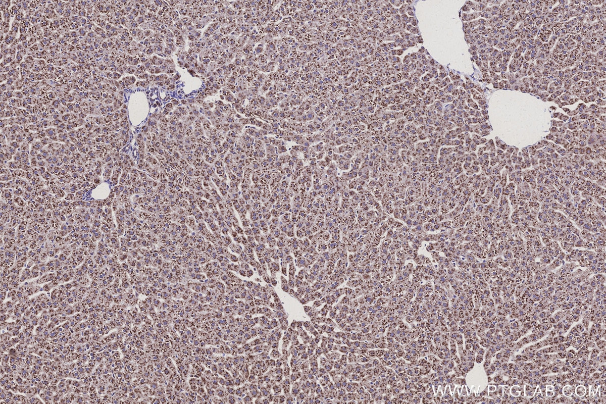 IHC staining of rat liver using 30851-1-AP Immunohistochemistry (IHC) staining of rat liver tissue using SSR3 Polyclonal antibody (30851-1-AP)