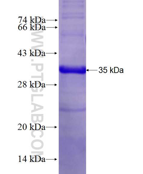 SSR3 fusion protein Ag28130 SDS-PAGE