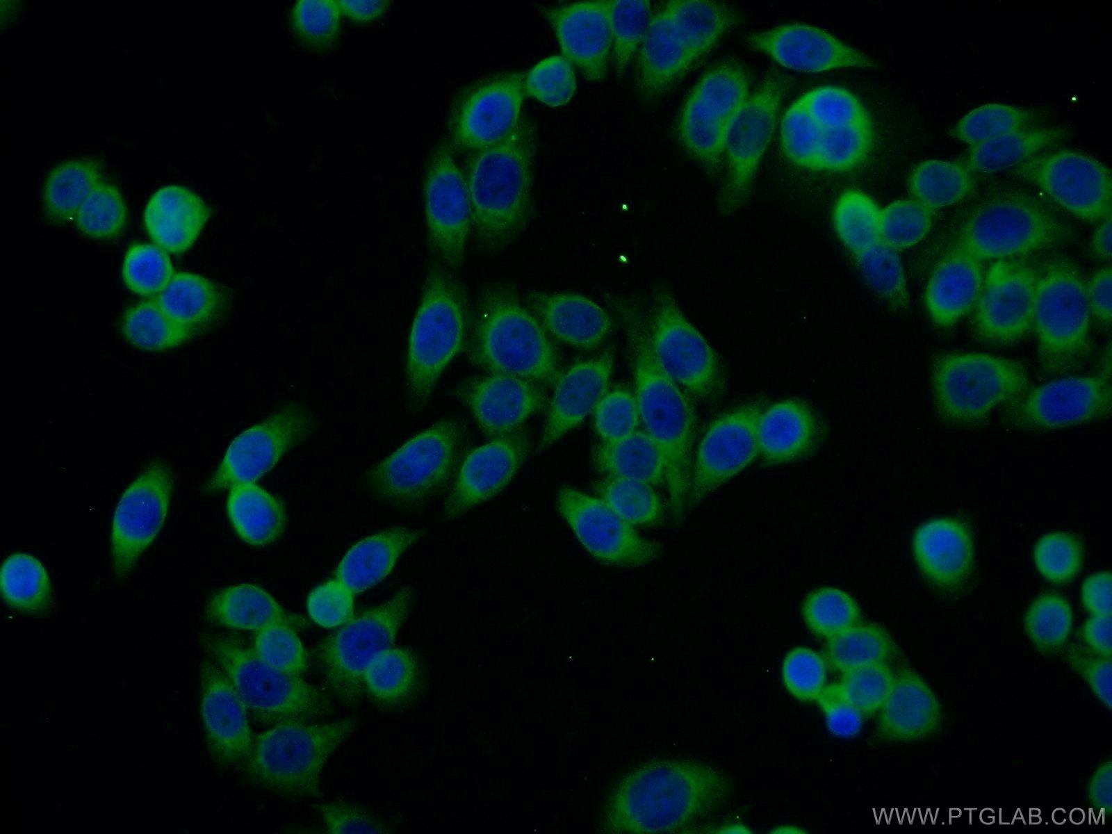 Immunofluorescence (IF) / fluorescent staining of HeLa cells using SSR4 Polyclonal antibody (11655-2-AP)