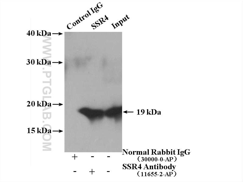Immunoprecipitation (IP) experiment of HeLa cells using SSR4 Polyclonal antibody (11655-2-AP)