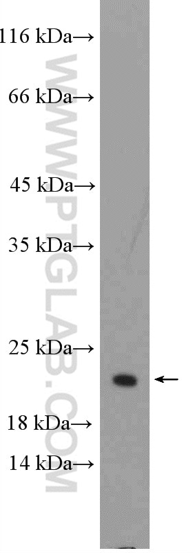 Western Blot (WB) analysis of human placenta tissue using SSR4 Polyclonal antibody (11655-2-AP)