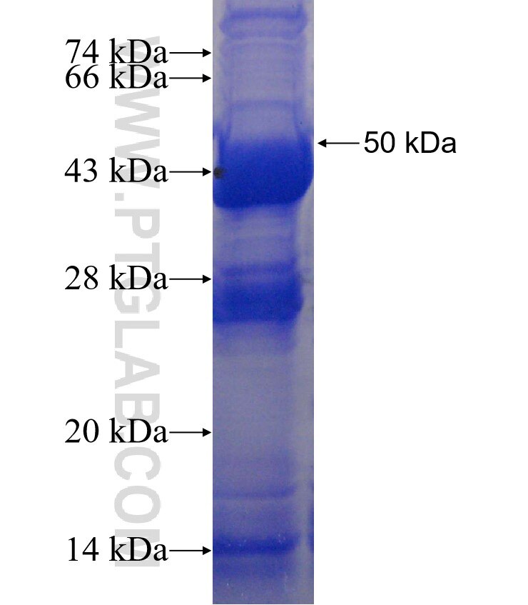 SSR4 fusion protein Ag2250 SDS-PAGE