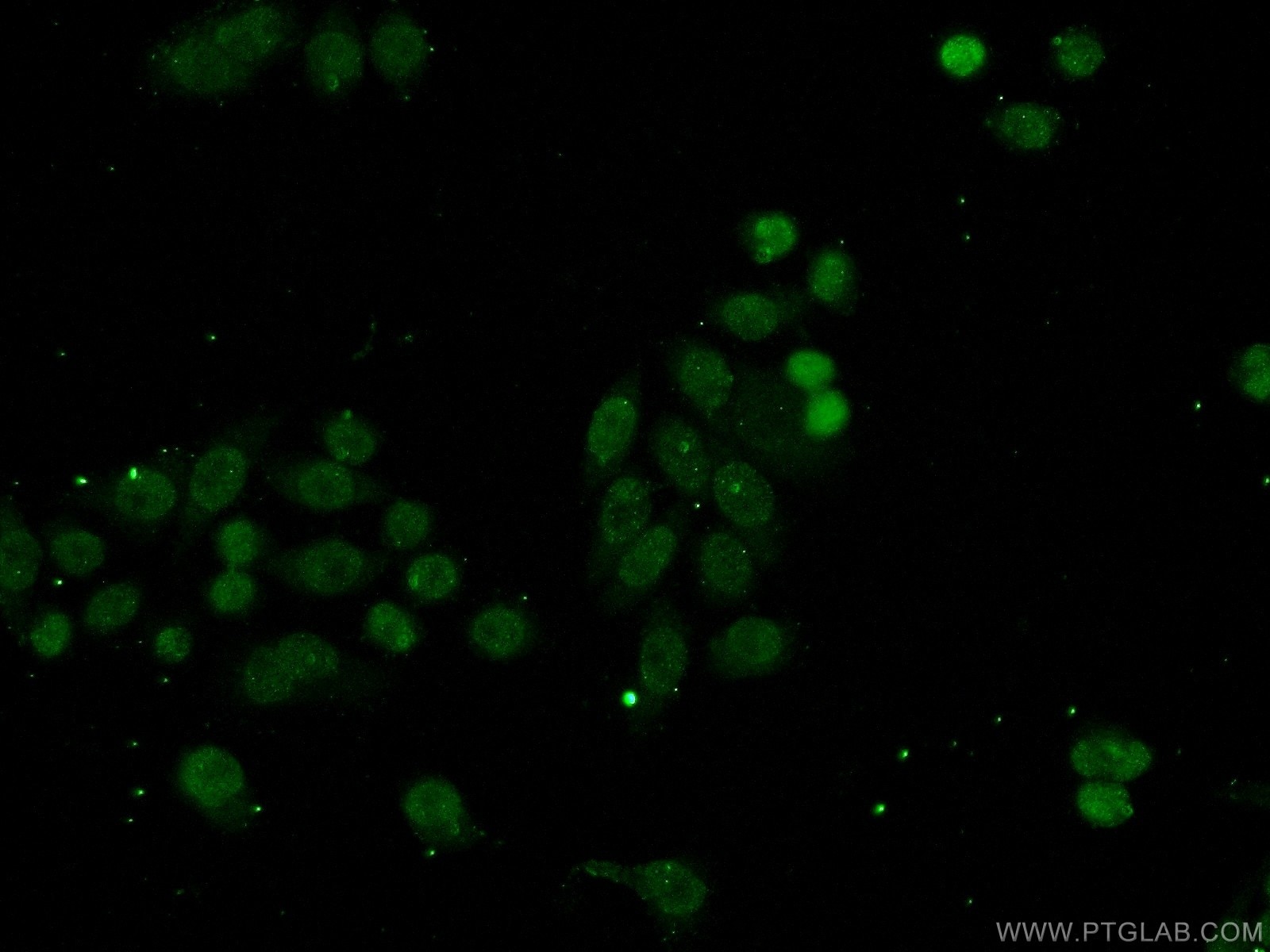 Immunofluorescence (IF) / fluorescent staining of HeLa cells using SSRP1 Polyclonal antibody (15696-1-AP)
