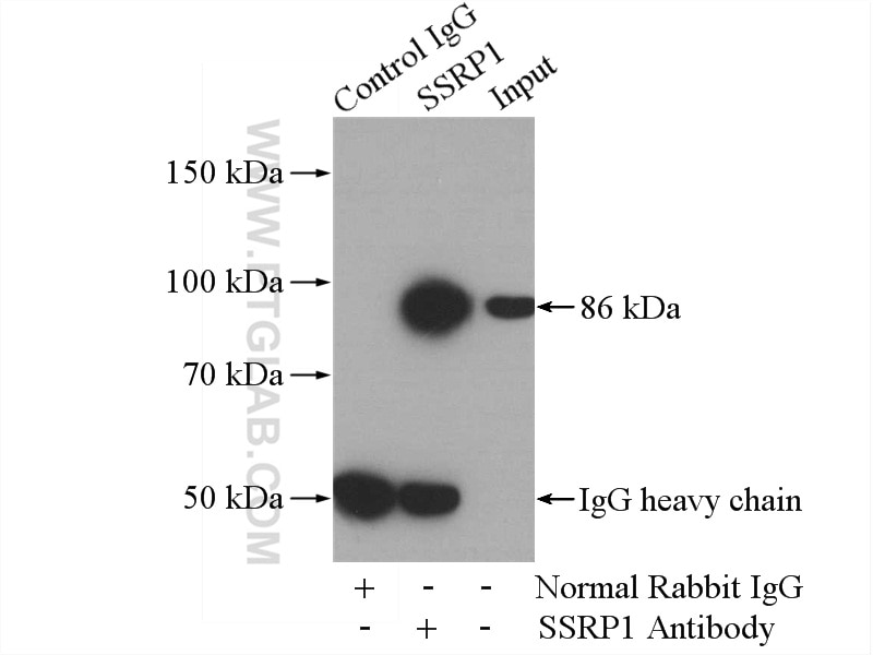 Immunoprecipitation (IP) experiment of mouse testis tissue using SSRP1 Polyclonal antibody (15696-1-AP)