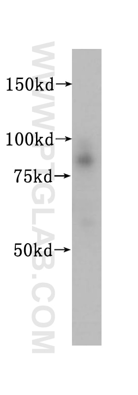 Western Blot (WB) analysis of HeLa cells using SSRP1 Polyclonal antibody (15696-1-AP)
